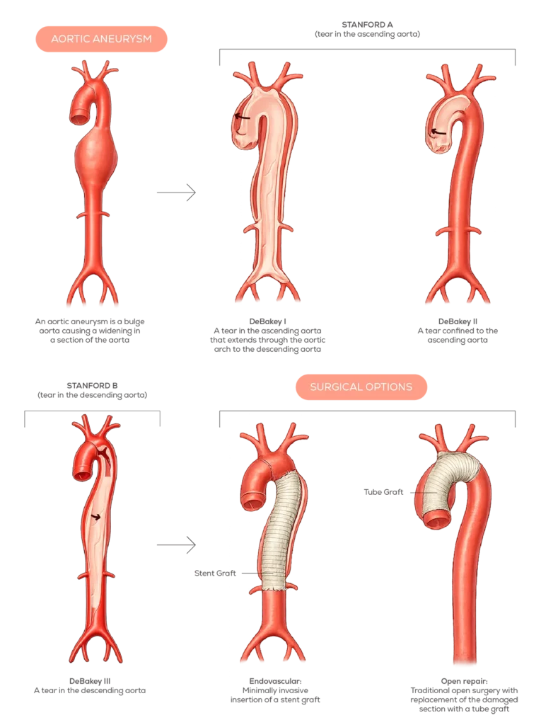 HTAD conditions illustration